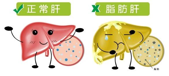 “减肥神药”司美格鲁肽再爆重磅消息：对脂肪肝有奇效 (2).jpg